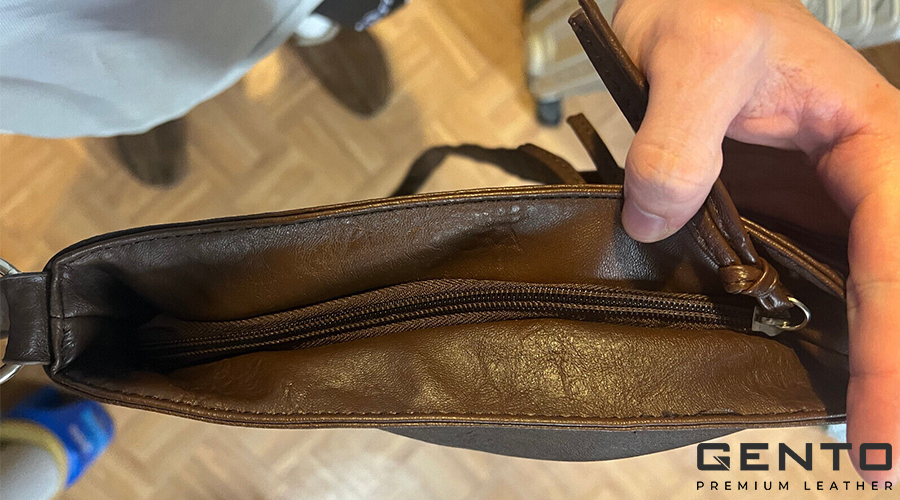 Những nguyên nhân khiến túi da bị nhăn 